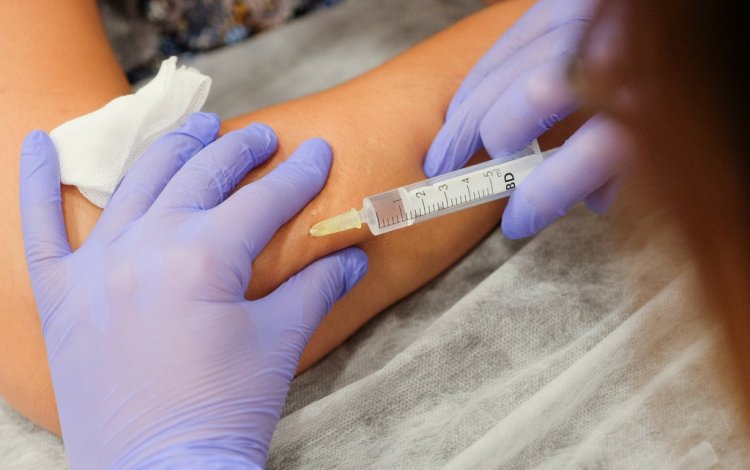 mesoterapia homeopática por joão martins