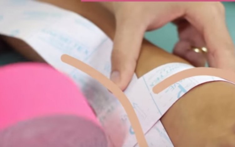 Kinesio Tape® numa entorse de Tornozelo: Aplicação passo-a-passo de taping