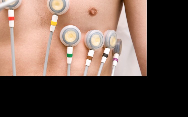 Fibrilhação auricular no ECG?