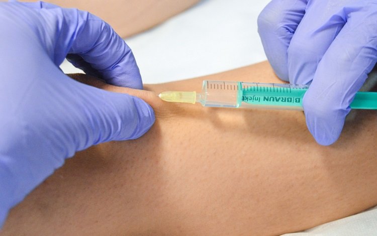 Serão as agulhas são uma barreira na adesão à Mesoterapia Homeopática? | Por Sara Xastre
