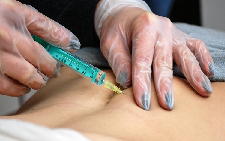 mesoterapia homeopática - conceitos, indicações e aplicações