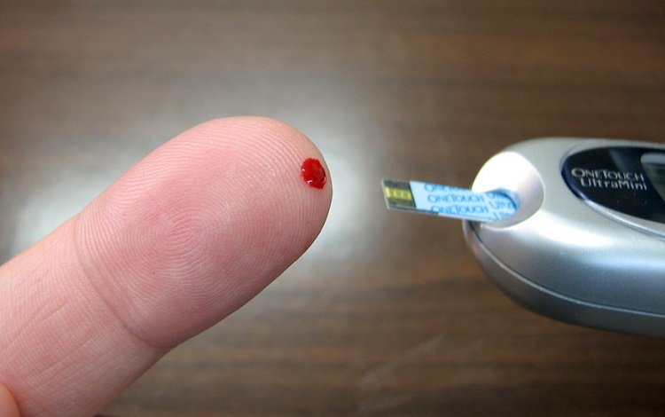 Hipoglicemia: como atuar?