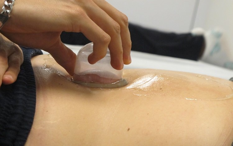 Vacuoterapia: fundamentos do método (e-book)