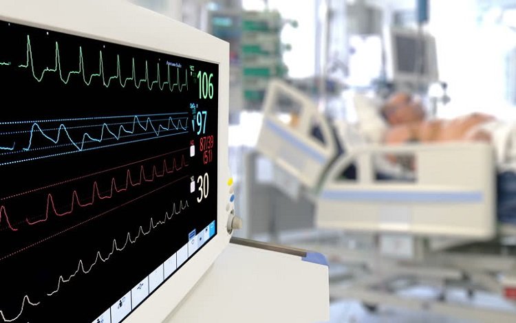 Fibrilhação auricular no ECG?