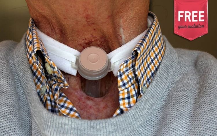 Indicações e avaliação na pessoa com ostomia respiratória (algoritmo de avaliação)