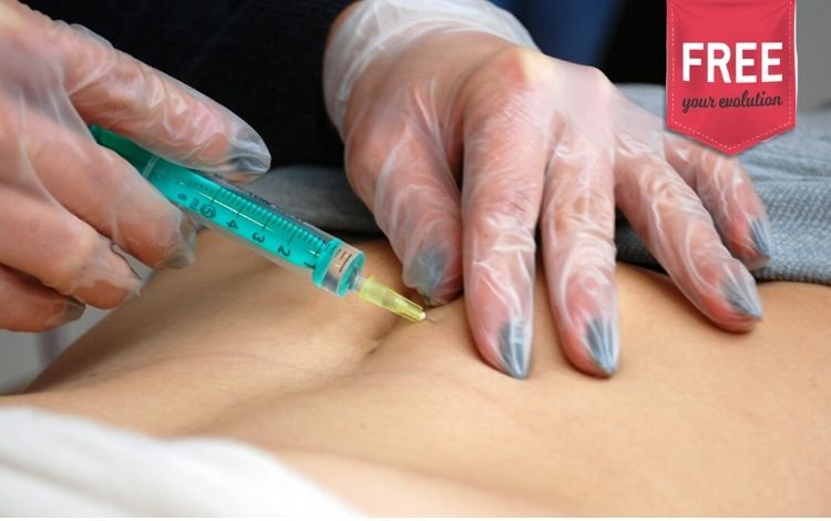 Mesoterapia homeopática nas estrias: vídeo passo a passo