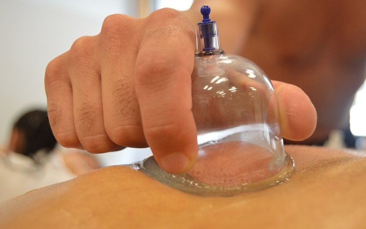 O que é a Vacuoterapia? Como se utiliza e quais os seus benefícios? - Bwizer