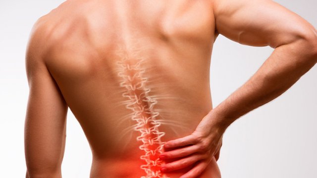 Low Back Pain 