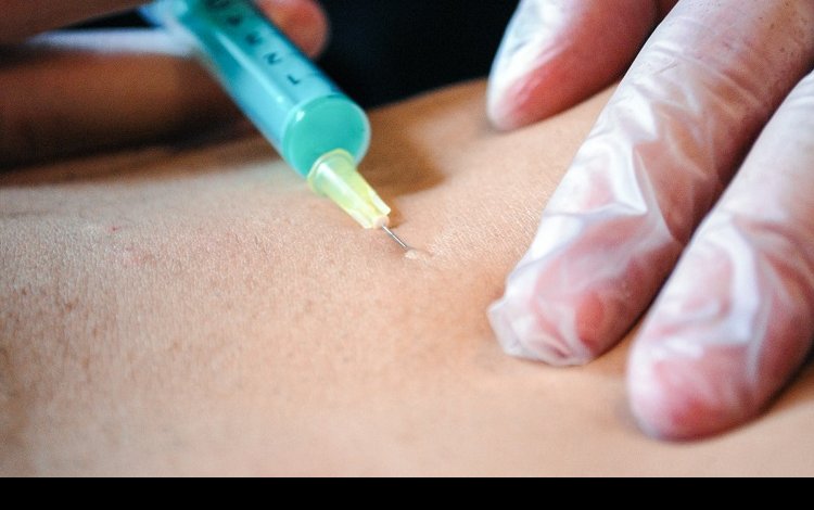 Mesoterapia Homeopática: Aplicação na Lombalgia de Origem Muscular (vídeo tutorial)