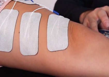 Eletroestimulação Muscular nas Disfunções Patelo-femorais (tutorial em vídeo passo-a-passo)