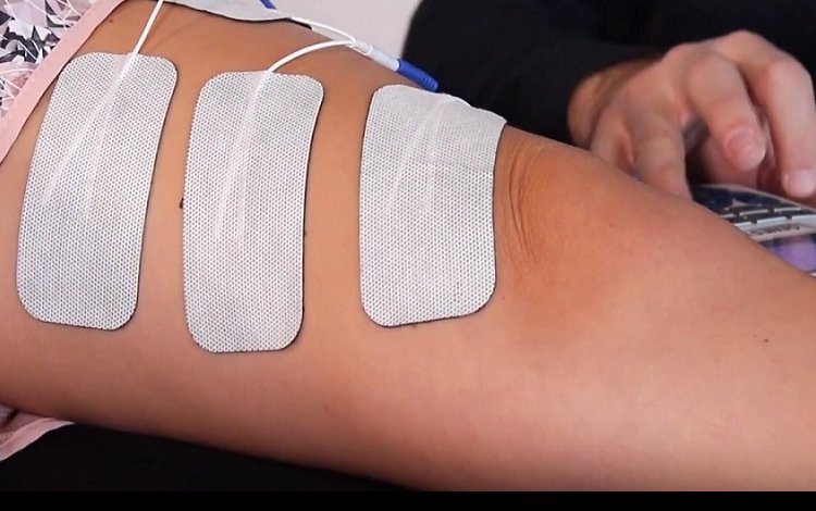 Eletroestimulação Muscular nas Disfunções Patelo-femorais